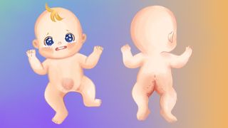Illustration einer leichten Windeldermatitis – gerötete Haut im Windelbereich ohne offene Stellen