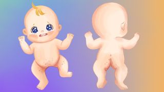 Illustration einer mittelschweren Windeldermatitis – intensivere Rötung mit betroffenen Hautfalten